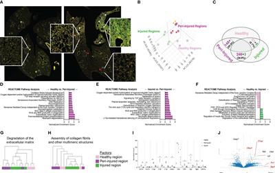 Spatial and phenotypic heterogeneity of resident and monocyte-derived macrophages during inflammatory exacerbations leading to pulmonary fibrosis